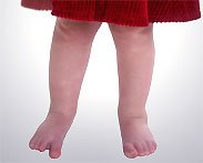 Массаж ребёнку при Х-образной (вальгусная) деформация нижних конечностей